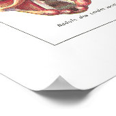 Maladies de Larynx Poster Anatomie Français (Coin)