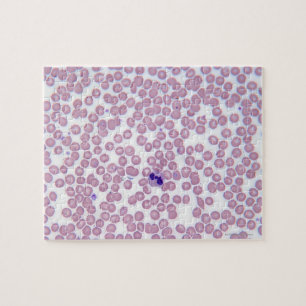Malariële bloedcellen legpuzzel