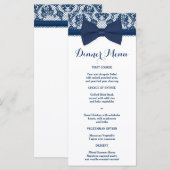 Marine Bleu & Blanc Dentelle Bow Menu Slim Dîner (Devant / Derrière)