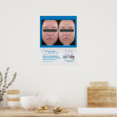 Marini Peel Clarify Resultaten 18x24" Poster (Keuken)