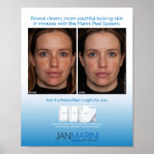 Marini Peel System 8x10" Poster (Voorkant)