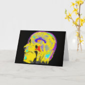 Mark's ingekleurde MRI Kaart (Gele Bloem)