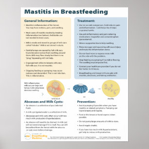 Mastitis in Borstvoeding Poster (Engels)
