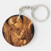 Maternity Sonogram Custom Photo Sleutelhanger (Achterkant)
