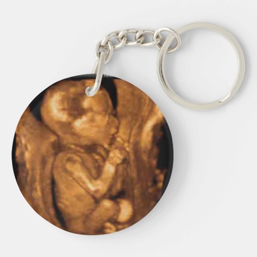 Maternity Sonogram Custom Photo Sleutelhanger (Achterkant)