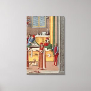 Medieval amputatie scène canvas afdruk