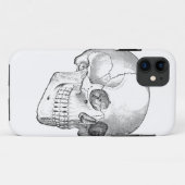 Medisch anatomische  schedel, monochroom Case-Mate iPhone case (Achterkant (horizontaal))