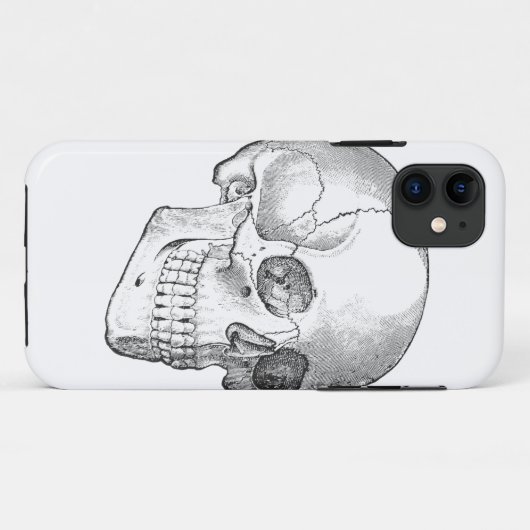 Medisch anatomische  schedel, monochroom Case-Mate iPhone case (Achterkant (horizontaal))