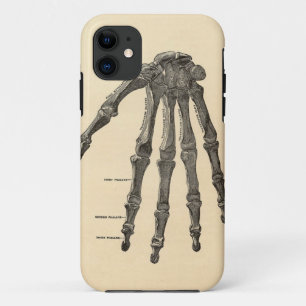 Medische anatomie handbotten iPhone hoes