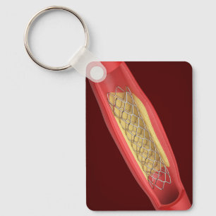 Medische stent in bloedvat sleutelhanger
