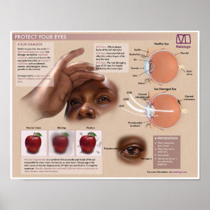 Melalogic Eye Protection Medical Poster