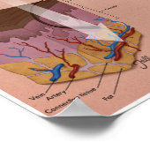 Melalogic Laser Treatment Medical Poster (Hoek)