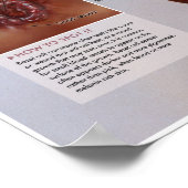 Melalogisch basaalcelcarcinoom medisch Poster (Hoek)