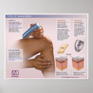 Melalogisch Het Belang van Sunscreen Medical Post Poster