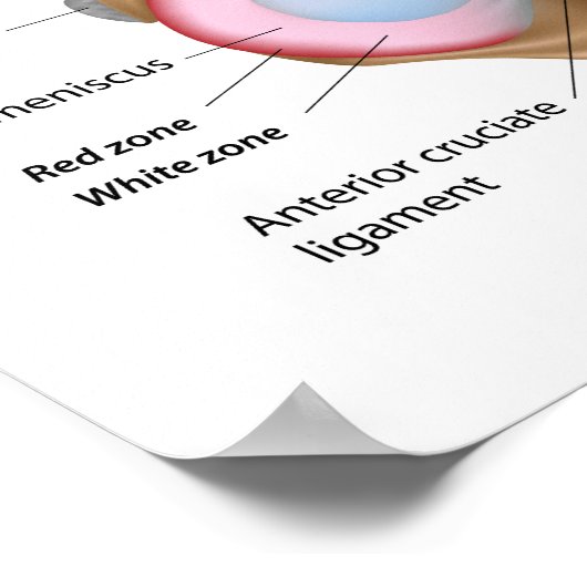 Menisci du genou Poster (Coin)