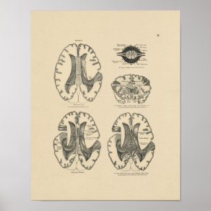 menselijke brein Anatomy 1880 Afdruk Poster