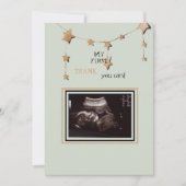 Merci photo Ultrasound amusant (Devant)