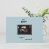 Merci photo Ultrasound de Baby Point de vue (Debout devant)