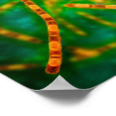 Microscopisch Uitzicht van antrax 2 Poster (Hoek)