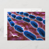 Microscopisch Uitzicht van bacteriële pneumonie 1 Briefkaart (Voorkant / Achterkant)