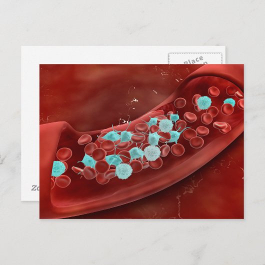 Microscopisch Uitzicht van bloeduitzetting Briefkaart (Voorkant / Achterkant)