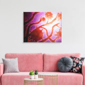 Microscopisch Uitzicht van histoplasmose Canvas Afdruk (Insitu (Woonkamer))