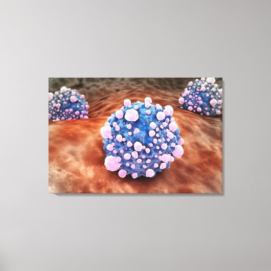Microscopisch Uitzicht van pancreaskankercellen 2 Canvas Afdruk (Voorkant)