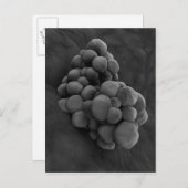 Microscopisch Uitzicht van tumor 1 Briefkaart (Voorkant / Achterkant)