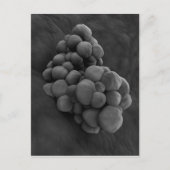 Microscopisch Uitzicht van tumor 1 Briefkaart (Voorkant)