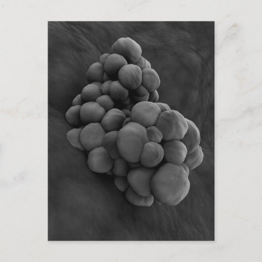 Microscopisch Uitzicht van tumor 1 Briefkaart (Voorkant)