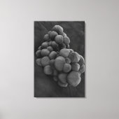 Microscopisch Uitzicht van tumor 1 Canvas Afdruk (Voorkant)