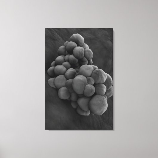 Microscopisch Uitzicht van tumor 1 Canvas Afdruk (Voorkant)