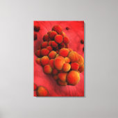 Microscopisch Uitzicht van tumor 2 Canvas Afdruk (Voorkant)