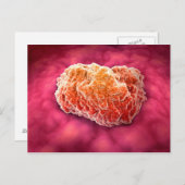 Microscopisch Uitzicht van tumor 3 Briefkaart (Voorkant / Achterkant)