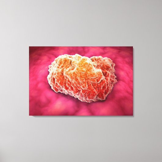 Microscopisch Uitzicht van tumor 3 Canvas Afdruk (Voorkant)