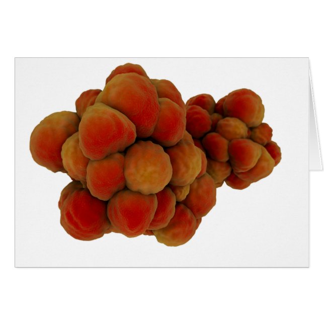 Microscopisch Uitzicht van tumor 4 (Voorkant Horizontaal)