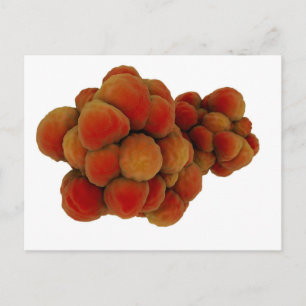 Microscopisch Uitzicht van tumor 4 Briefkaart