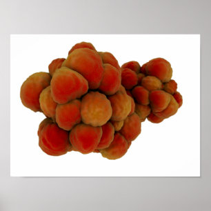 Microscopisch Uitzicht van tumor 4 Poster