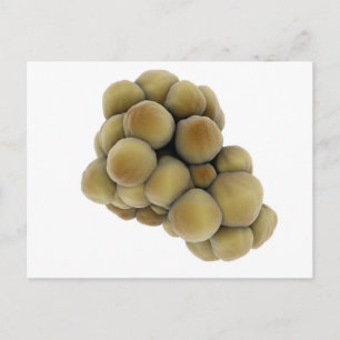 Microscopisch Uitzicht van tumor 5 Briefkaart