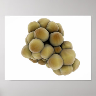 Microscopisch Uitzicht van tumor 5 Poster