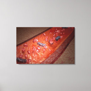 Microscopische weergave van een bloedinfectie canvas afdruk