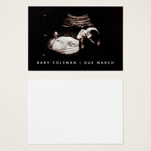 Mini pack de cartes Sonogramme Faire-part grossess (Devant & derrière)