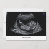 Moderne Minimalistische Sonogram Foto Baby Shower Kaart (Achterkant)