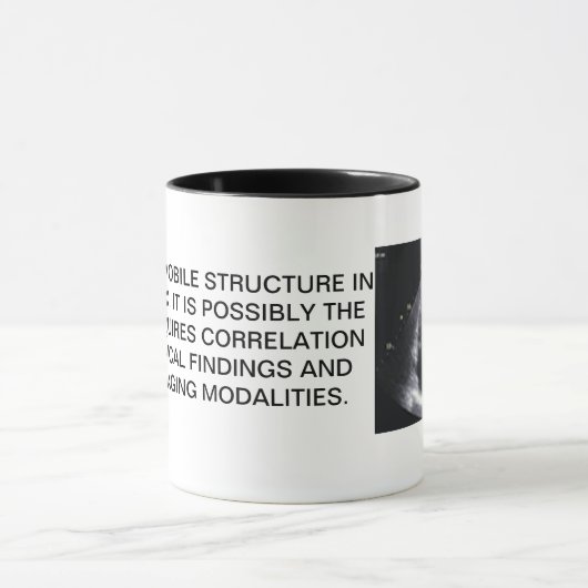 MOK CARDIAC ECHO (Midden)