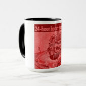 Mok harttransplantatie (Voorkant links)