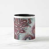 mok koffie! "Malignant Struma Ovarii" (Midden)