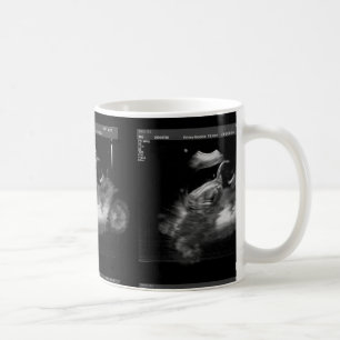 Mok motorfiets Sonogram