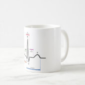 MOK Sinus Rhythm ECG Diagram (Voorkant rechts)