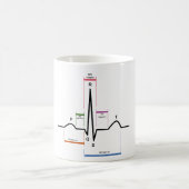 MOK Sinus Rhythm ECG Diagram (Center)