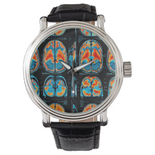 Montre Analyse cérébrale par IRM